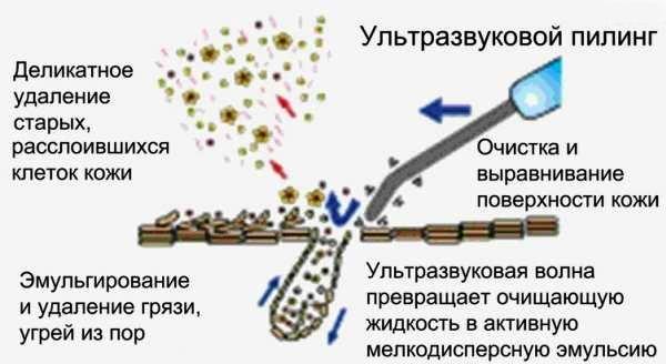 Лопатка прибора "Gezatone HS2307i" вибрируя, проникает "вглубь", прочищая поры, убирая акне, комедоны и т.п.