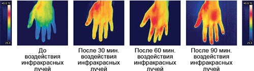 Уже через полчаса после включения перчаток кисти рук заметно теплеют (нажмите на изображение, чтобы увеличить)